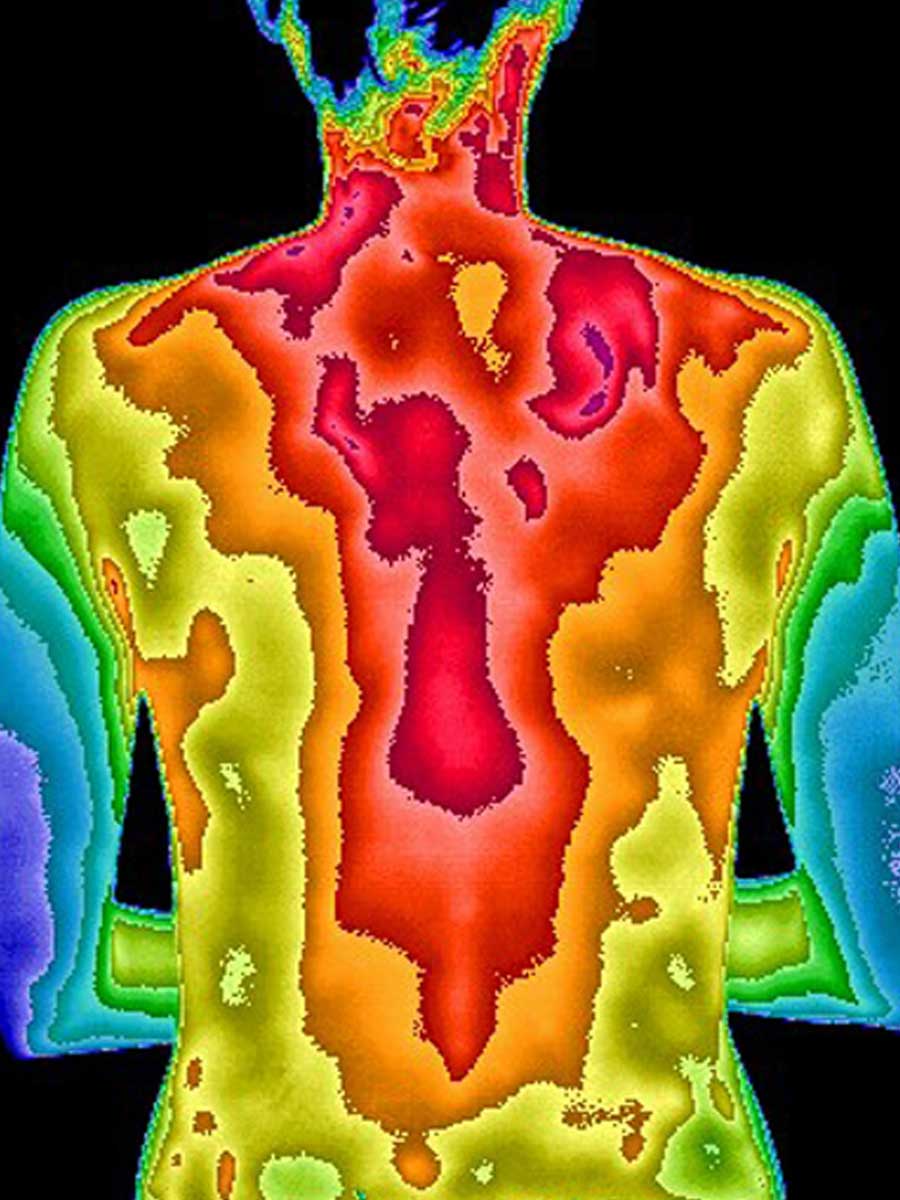 Thermogram of back