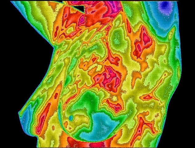 thermography